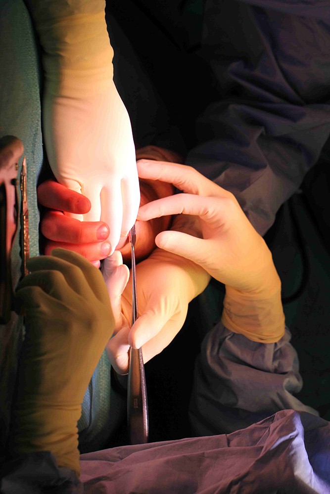 Chirurgie de la main